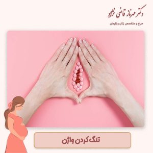 تنگ کردن واژن - دکتر قاضی نژاد
