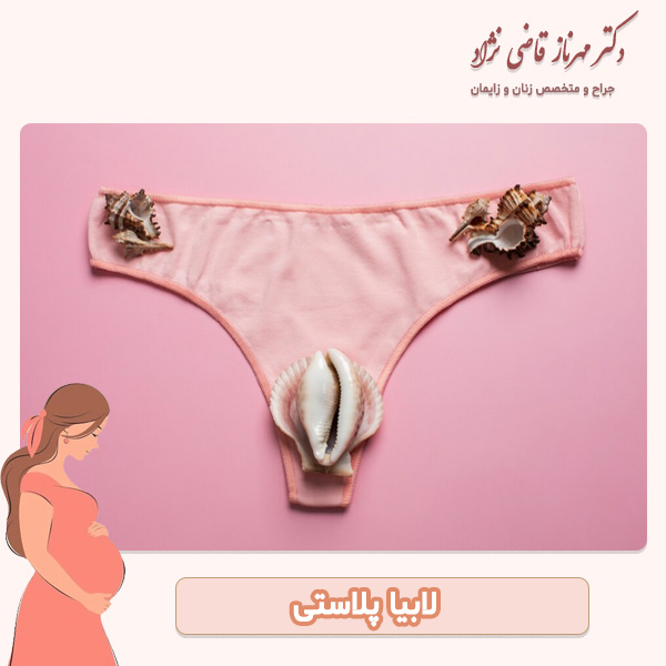 لابیاپلاستی - دکتر قاضی نژاد