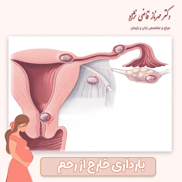 شکل گیری مشکل - دکتر قاضی نژاد