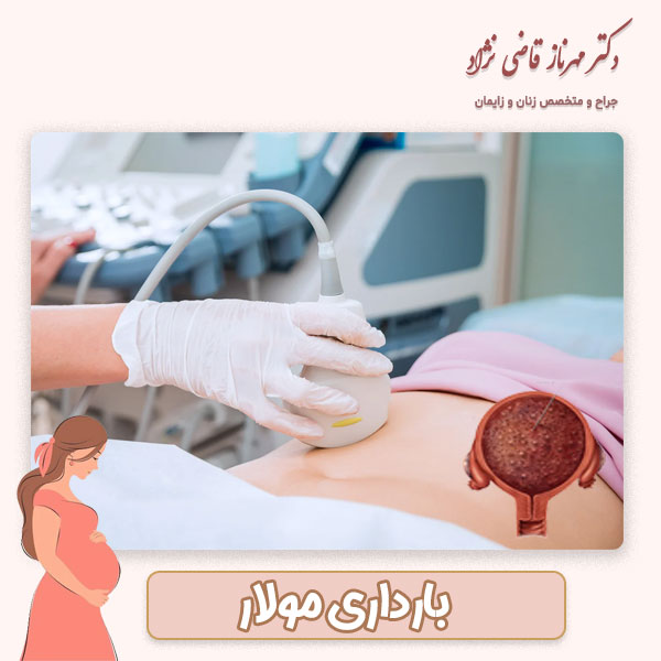 بارداری مولار - دکتر قاضی نژاد