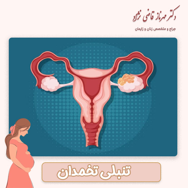 تنبلی تخمدان - دکتر مهرناز قاضی نژاد