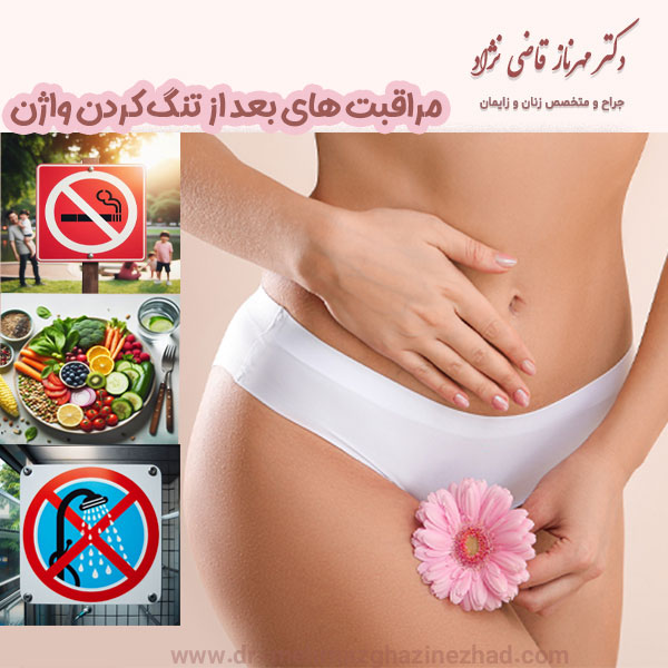 مراقبت های بعد از تنگ کردن واژن - https://dr-mehrnazghazinezhad.com/