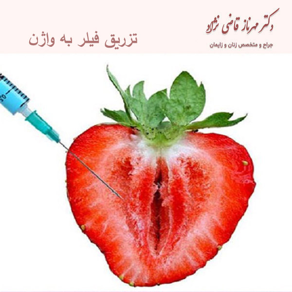 تزریق ژل به واژن