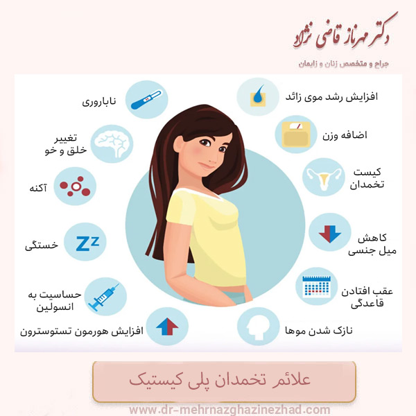 نشانه های ابتلا به سندروم تخمدان پلی کیستیک