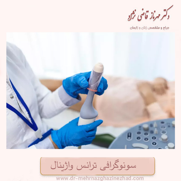 سونوگرافی ترانس واژینال
