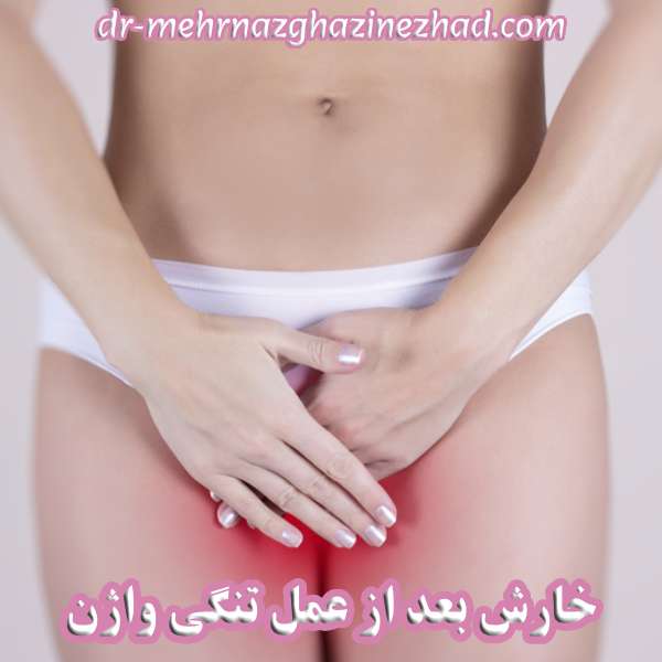 خارش بعد از عمل تنگی واژن
