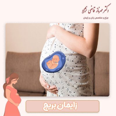 زایمان بریچ - دکتر قاضی نژاد