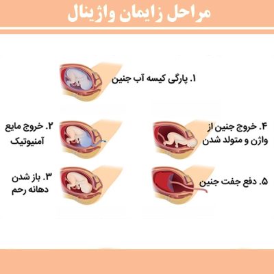 زایمان طبیعی در شوشتر - دکتر قاضی نژاد
