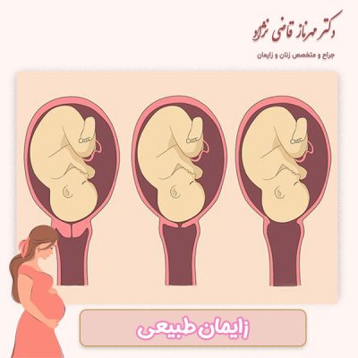 زایمان طبیعی - دکتر مهرناز قاضی نژاد